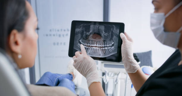 Best Broken or Chipped Tooth Repair in San Marino, CA